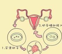 感染hiv可以做试管婴儿吗？有艾滋病的人能做试管婴儿吗？